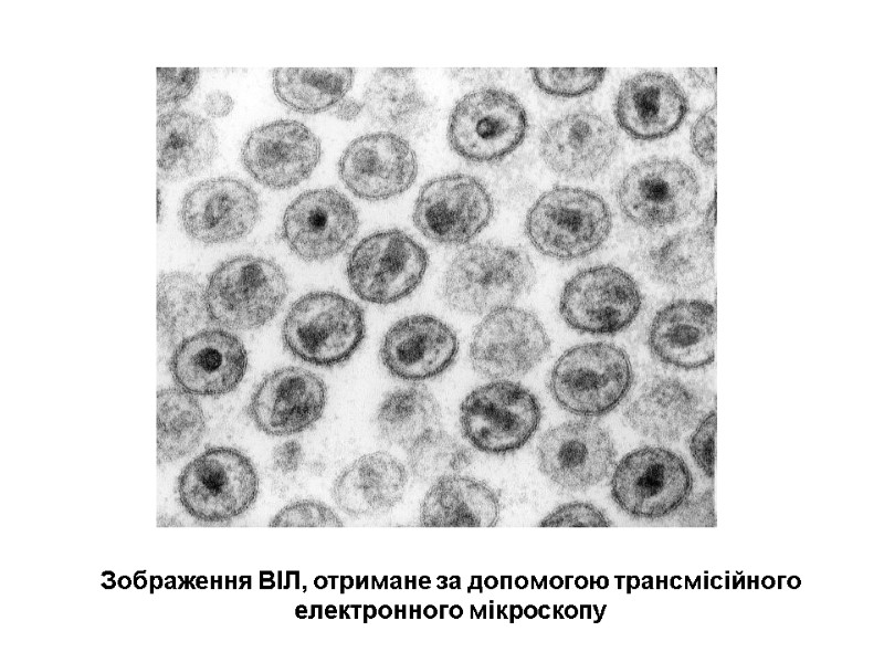 Зображення ВІЛ, отримане за допомогою трансмісійного електронного мікроскопу